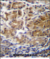 PDPR Antibody (C-term)